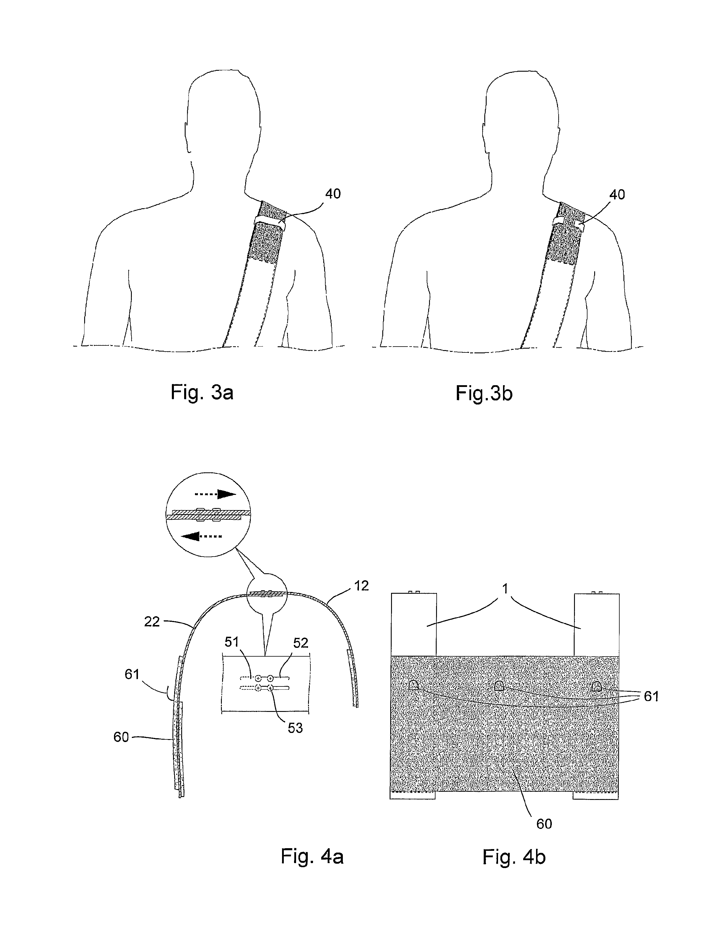 Stress-reducer for shoulder and the use thereof