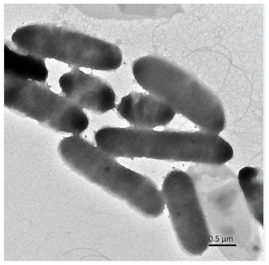 A kind of bacterial enzyme mixed preparation containing Stenotrophomonas maltophilia and its application