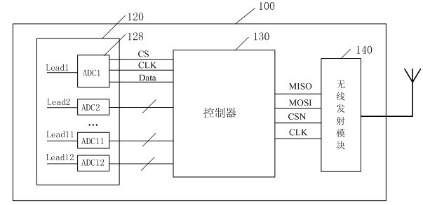 12-lead wireless realtime electrocardiograph monitoring and analysis system