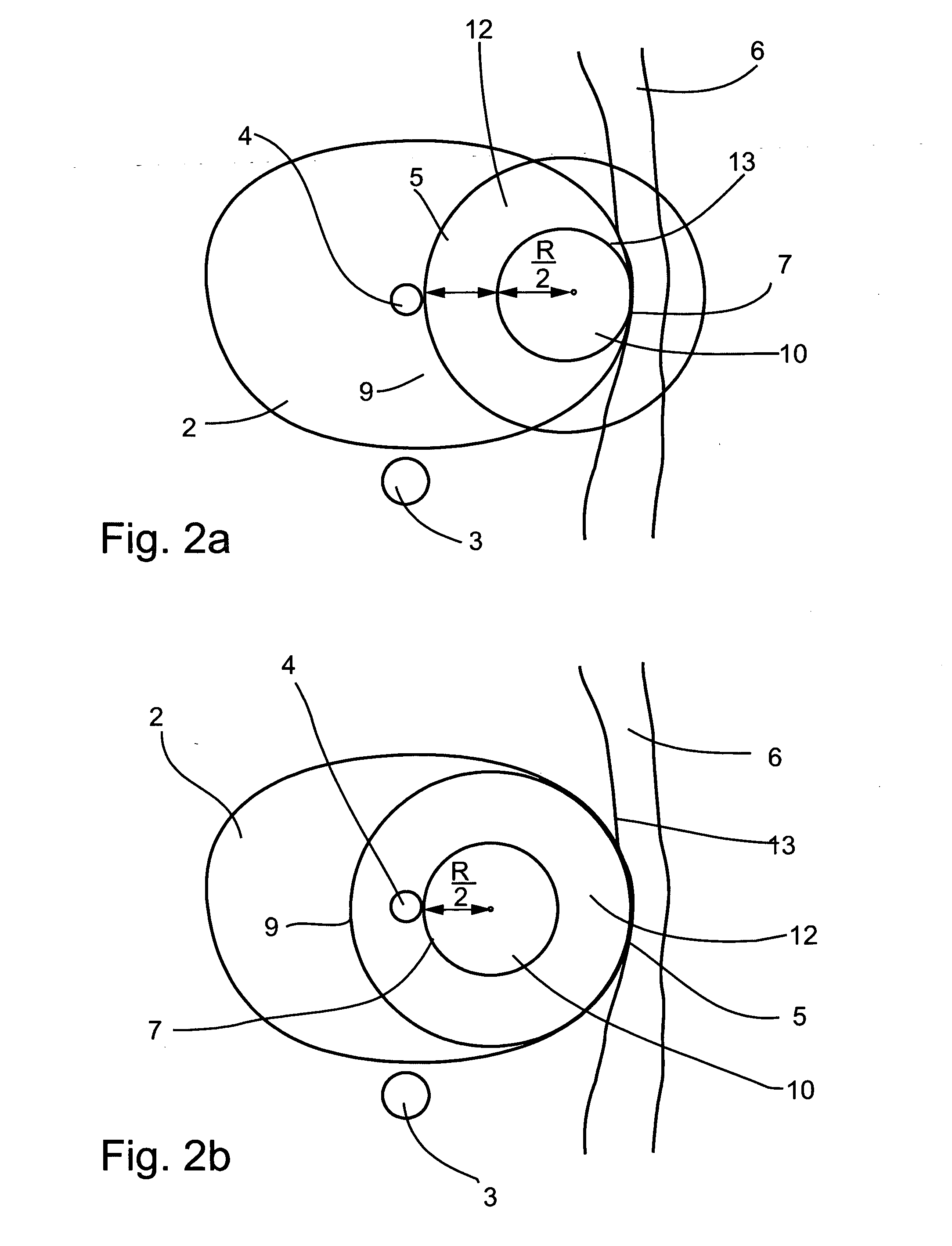 Planning and facilitation systems and methods for cryosurgery
