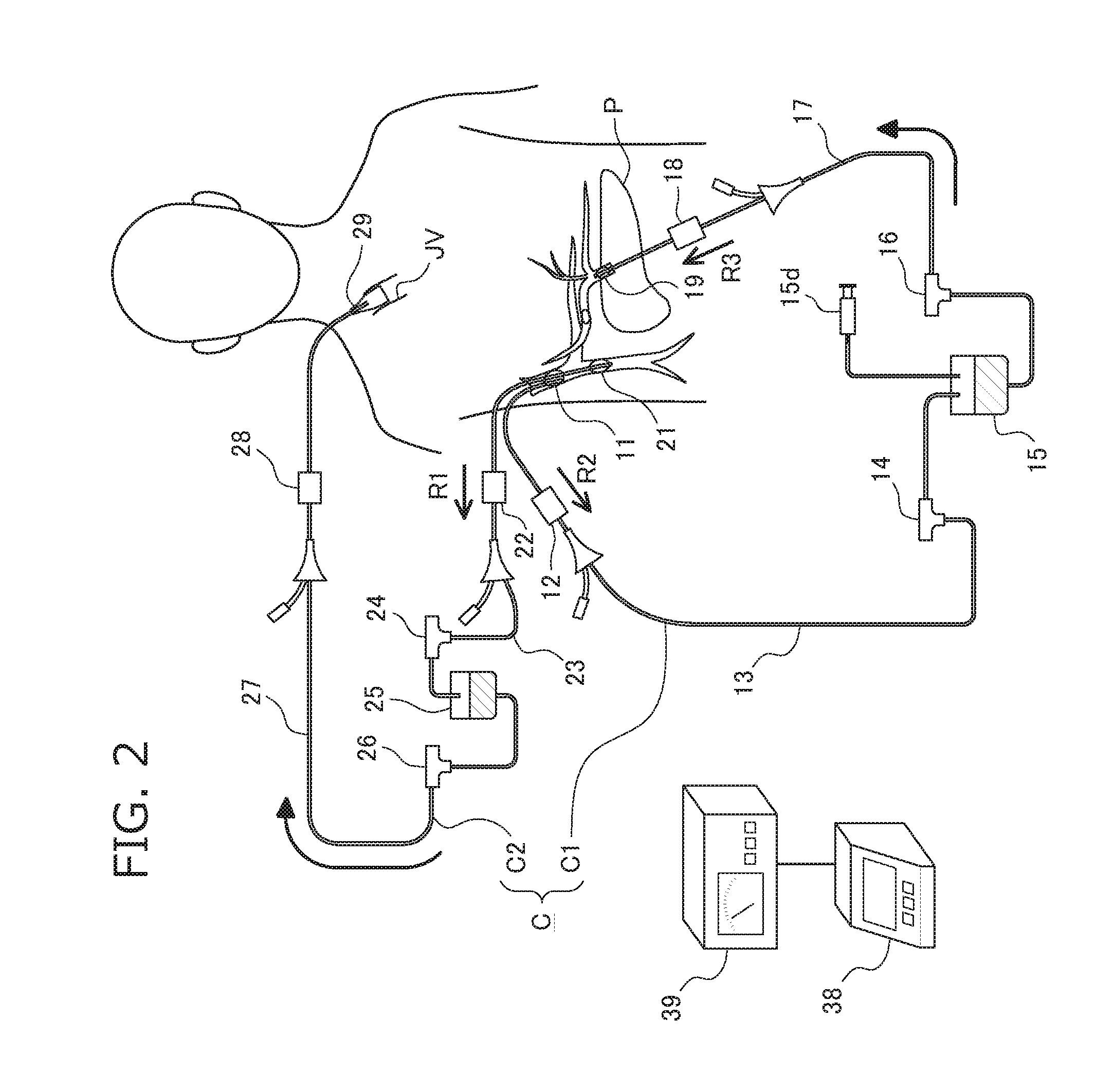 Pancreas perfusion device, method for controlling same, and method for pancreas perfusion