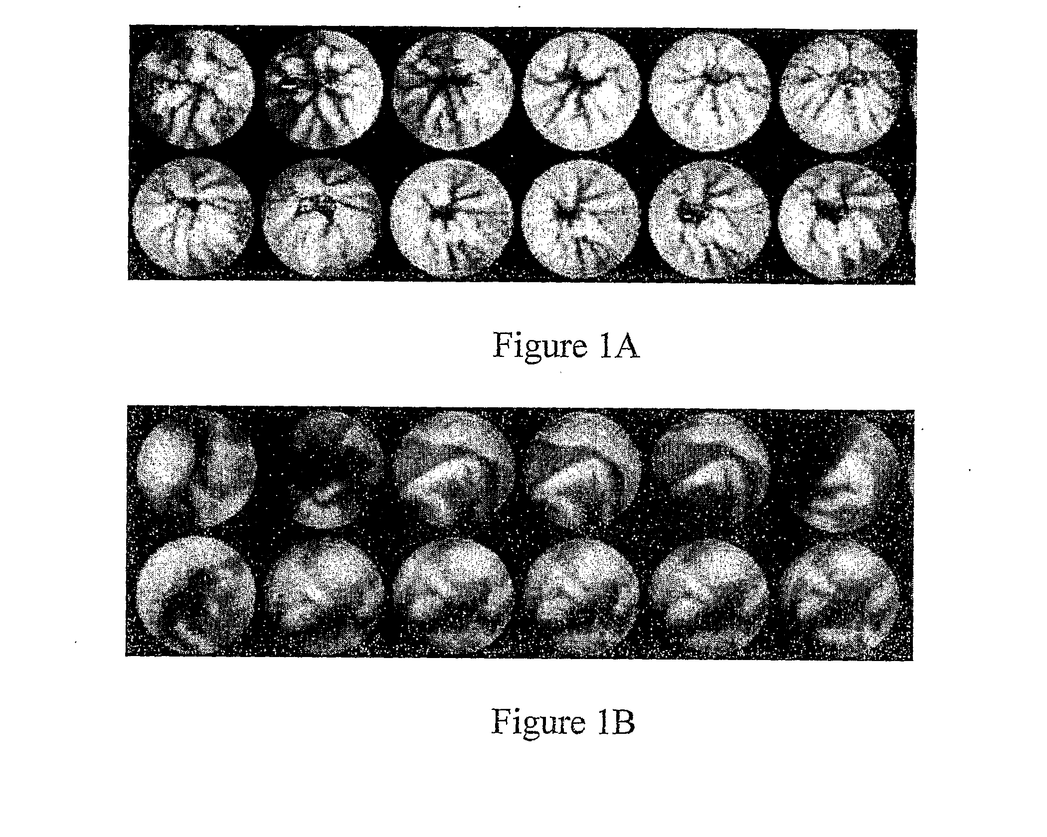 Device, system and method for automatic detection of contractile activity in an image frame