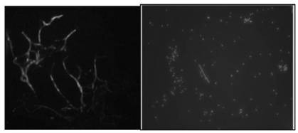 A method for genetic transformation of Rapeseed black shank mediated by Agrobacterium