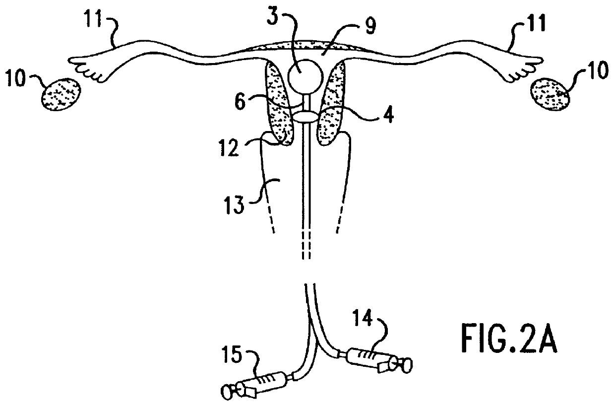 Method and device for use in the diagnosis of inflammatory states in the urogenital tract