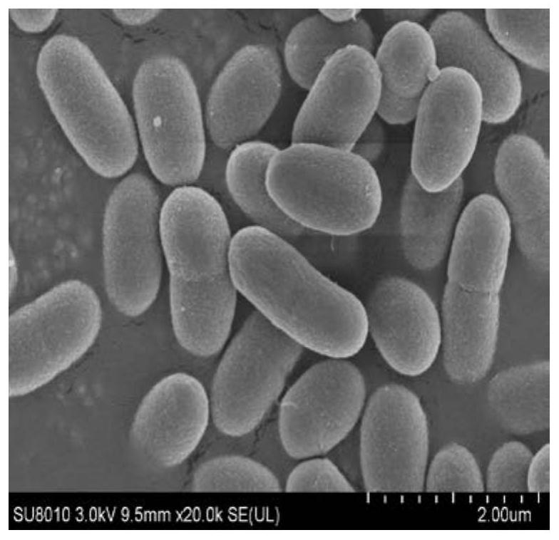 microbacterium and its application