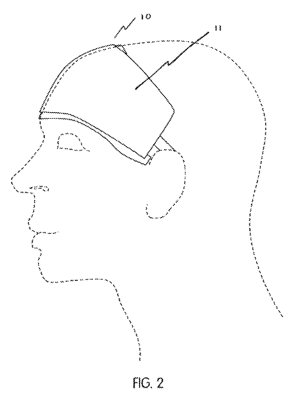 Noninvasive, regional brain thermal stimuli for the treatment of neurological disorders