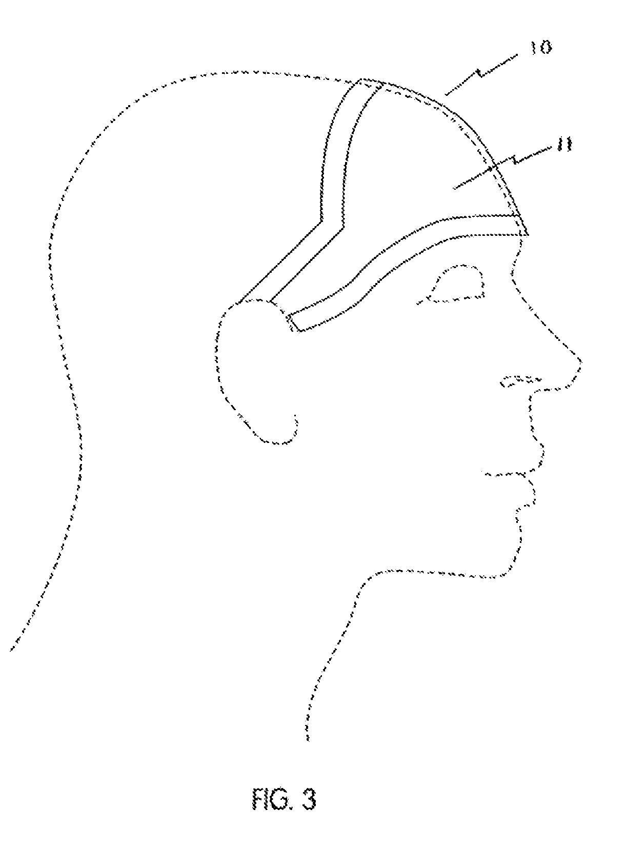 Noninvasive, regional brain thermal stimuli for the treatment of neurological disorders