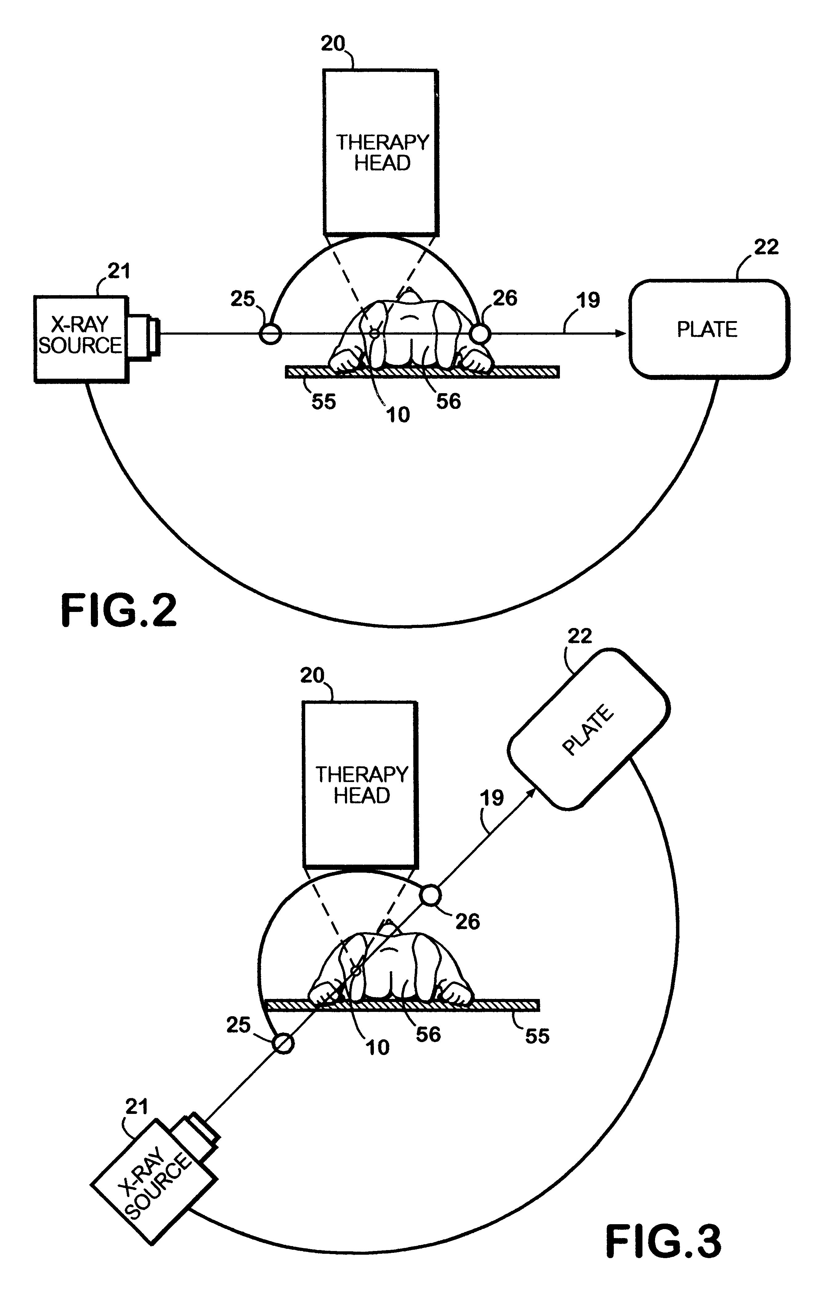 Method for using acoustic shock waves in the treatment of an ischemic condition