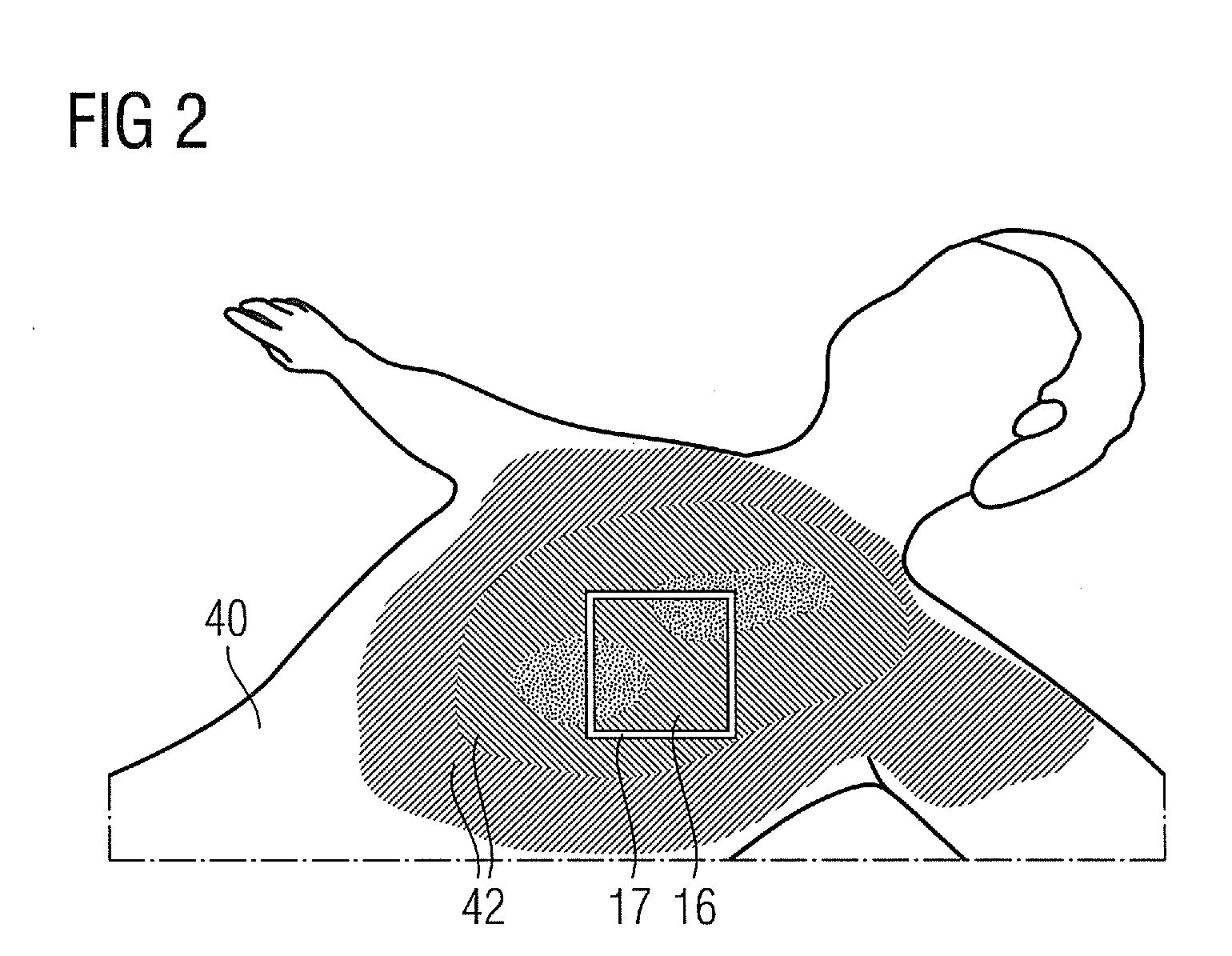 Method for visualizing a patient dose, computer program product and X-Ray apparatus