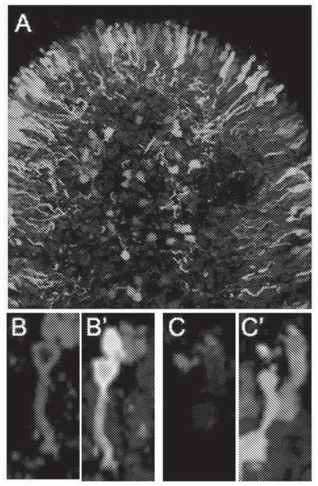 Compositions and methods for treating retinal disorders