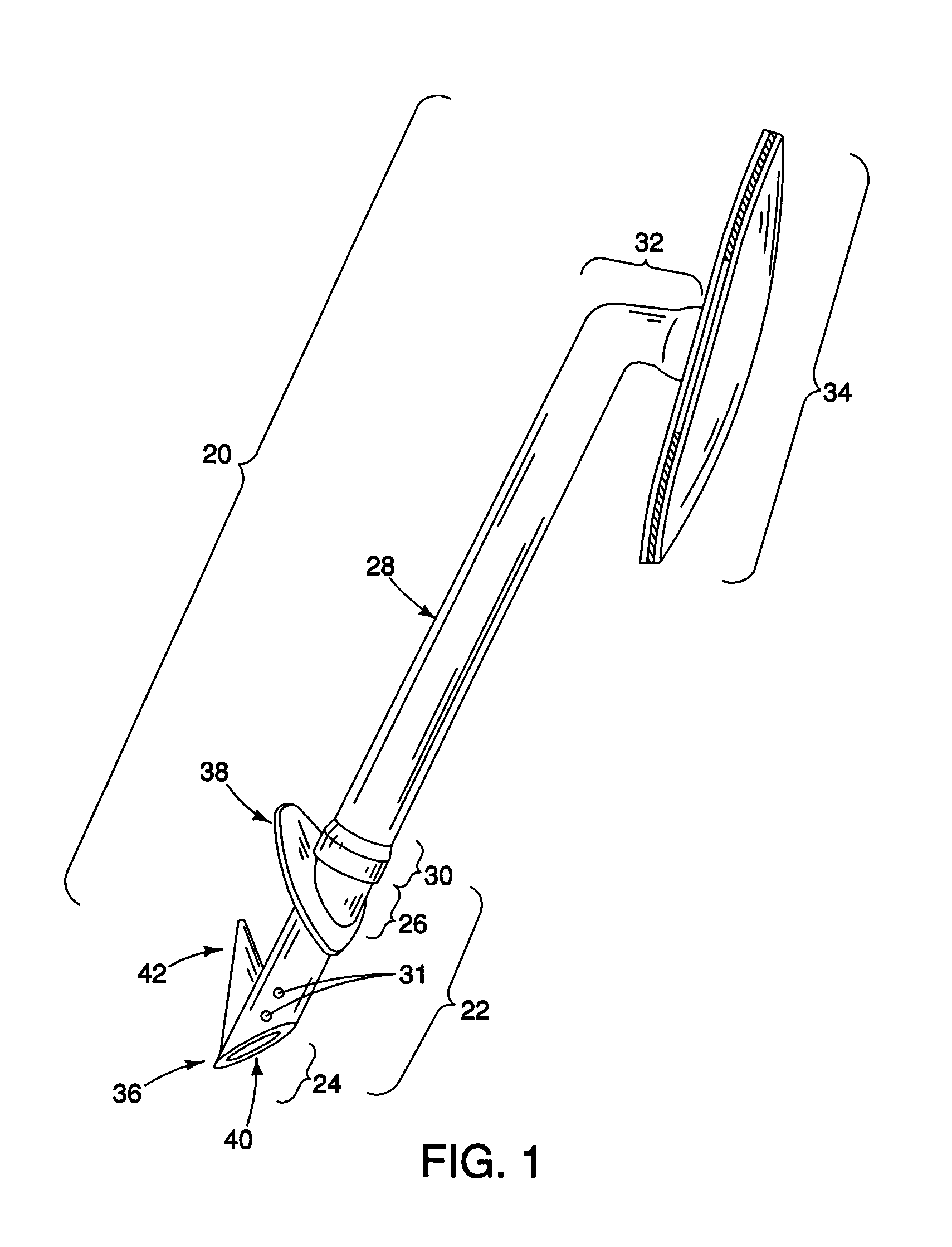 Method and apparatus for reducing intraocular pressure