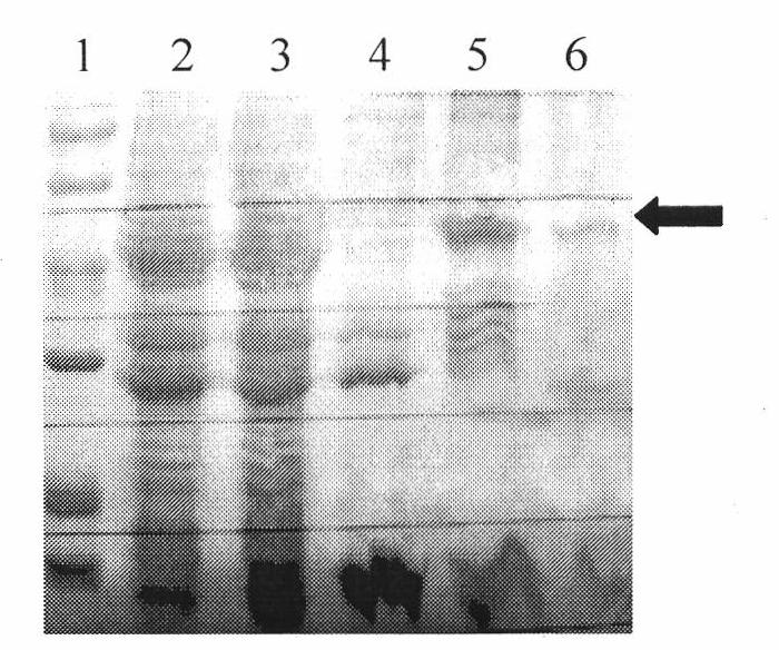 Humanized HIRRP (HSV-1 Infection Related Repress) protein molecule for resisting HSV1 virus infection