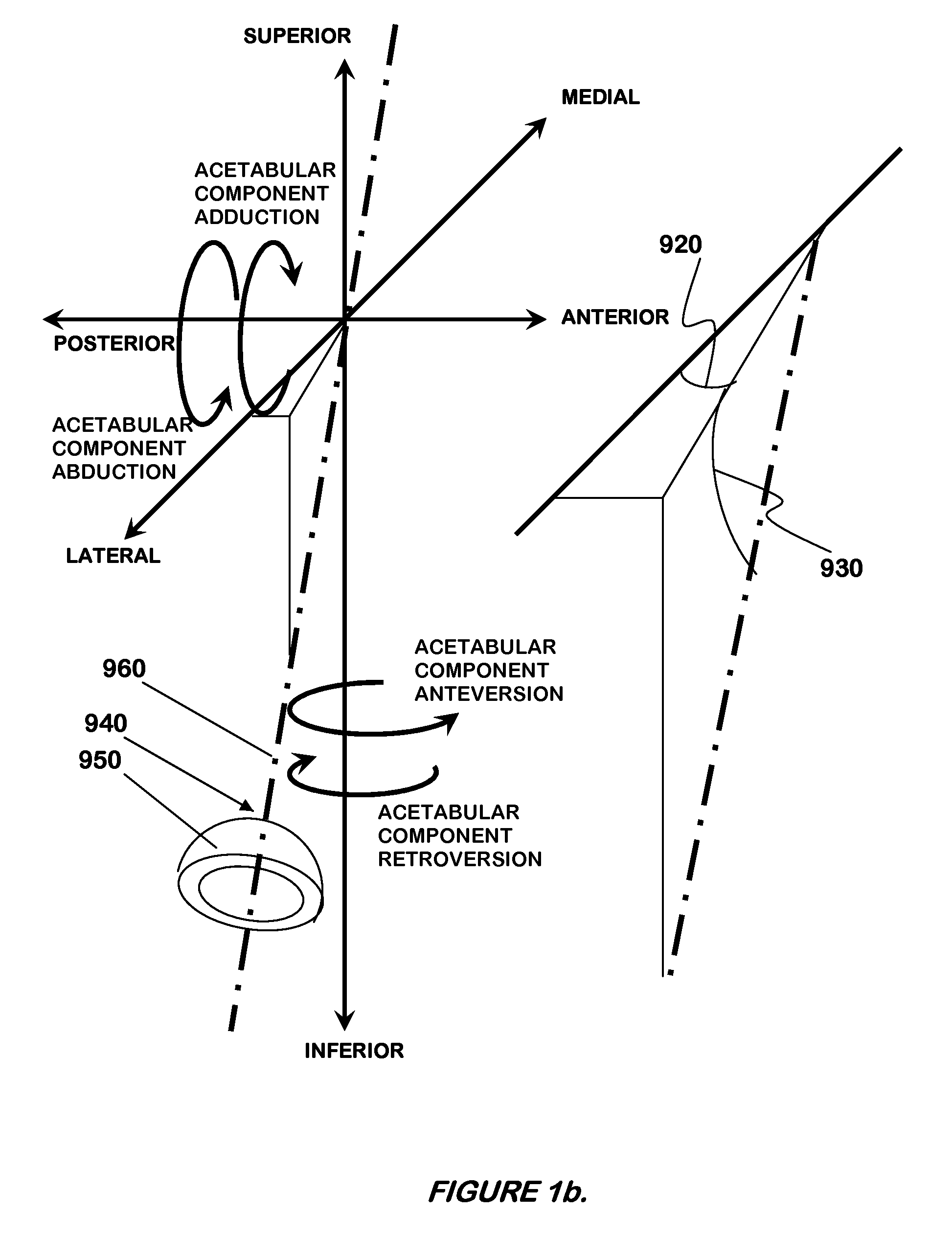 Method and system of mapping femoral head for acetabular prosthesis alignment