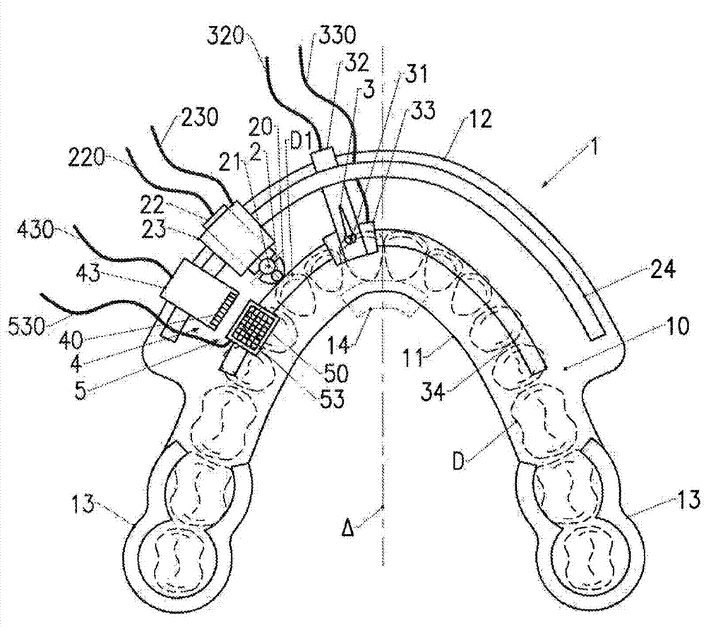 Intraoral device for automated preparation of the teeth with a view to performing partial or peripheral restorations