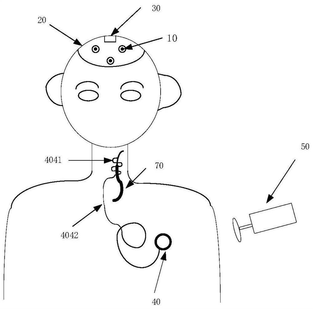 Closed-loop vagus nerve stimulator based on scalp electroencephalogram