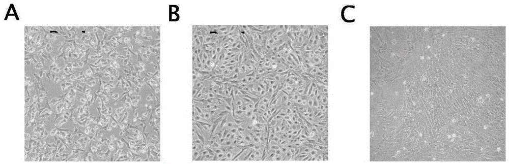 Establishment method for differentiating swine germline stem cells into sperms in vitro