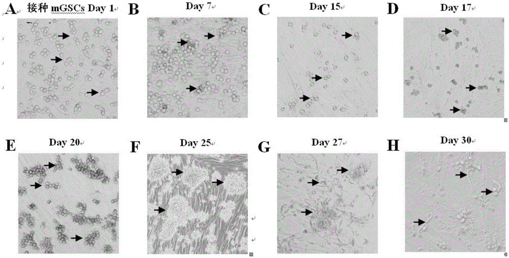 Establishment method for differentiating swine germline stem cells into sperms in vitro