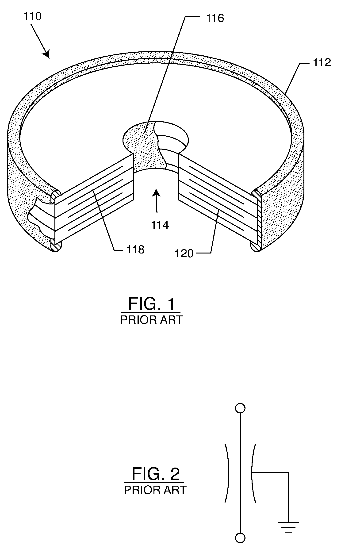 Hermetic feedthrough terminal assembly with wire bond pads for human implant applications