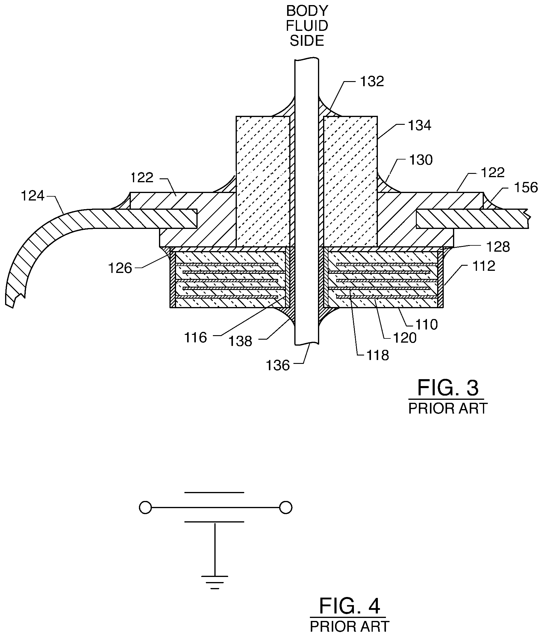 Hermetic feedthrough terminal assembly with wire bond pads for human implant applications