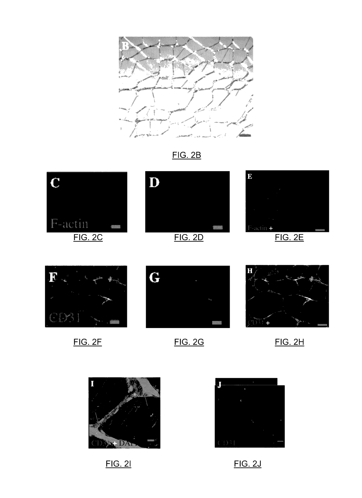Controllable formation of microvascular networks using sacrificial microfiber templates