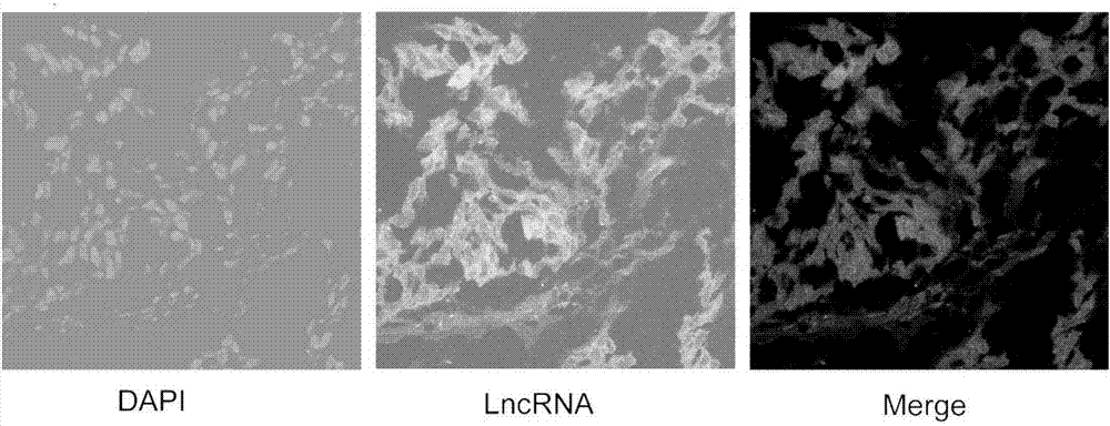 Fluorescence in-situ hybridization detection method for lncRNA in lung cancer tissue