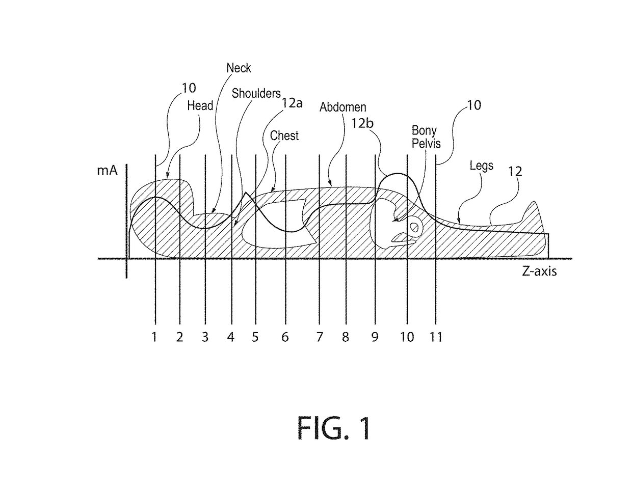 Image processing system and method for detecting an anatomical marker within an image study