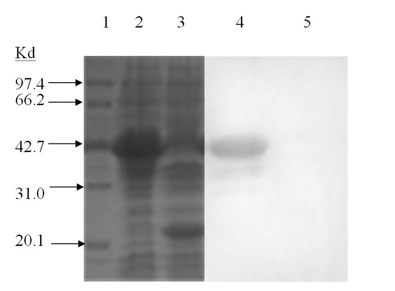 Enzyme-linked immunosorbent assay (ELISA) kit for duck hepatitis virus type-I serum antibody, test method and application thereof