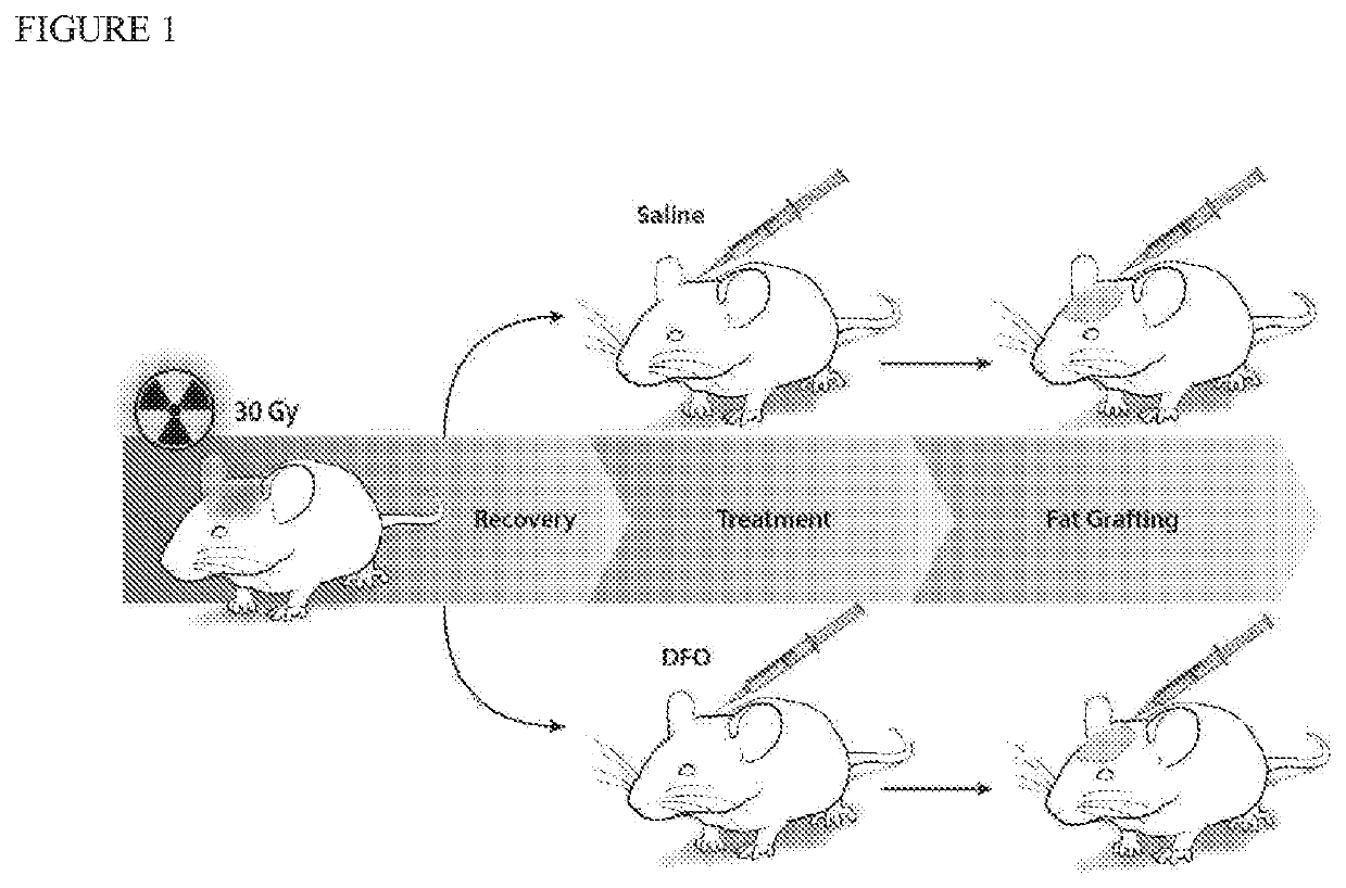 Conditioning irradiated tissue for fat graft retention