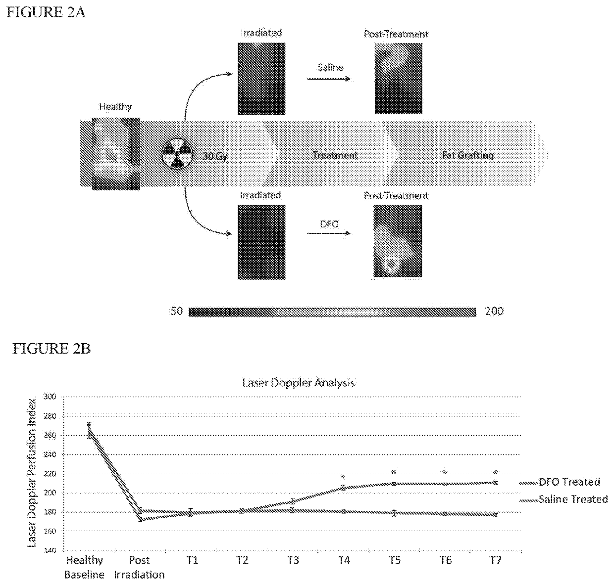 Conditioning irradiated tissue for fat graft retention