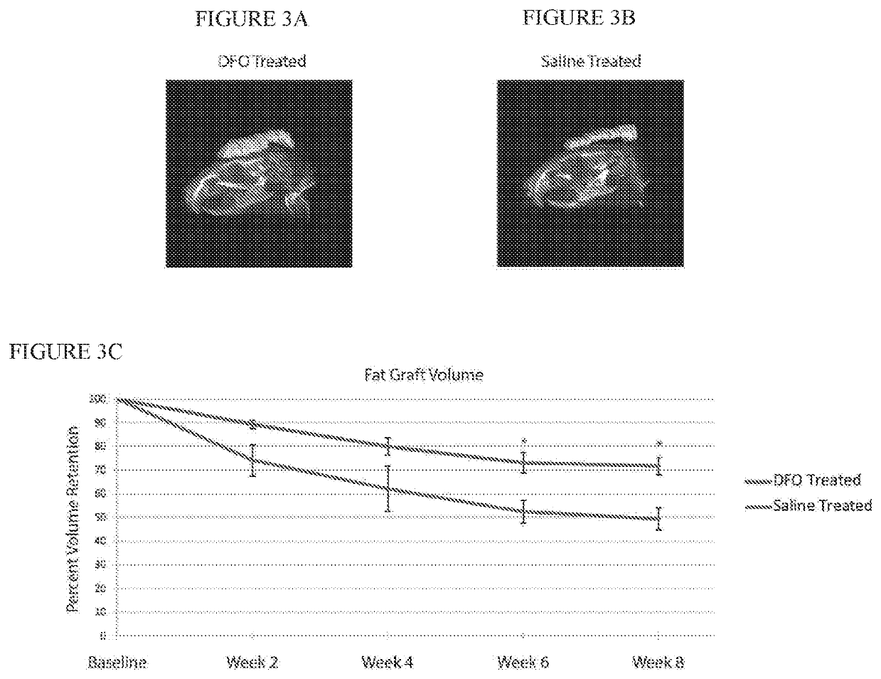 Conditioning irradiated tissue for fat graft retention