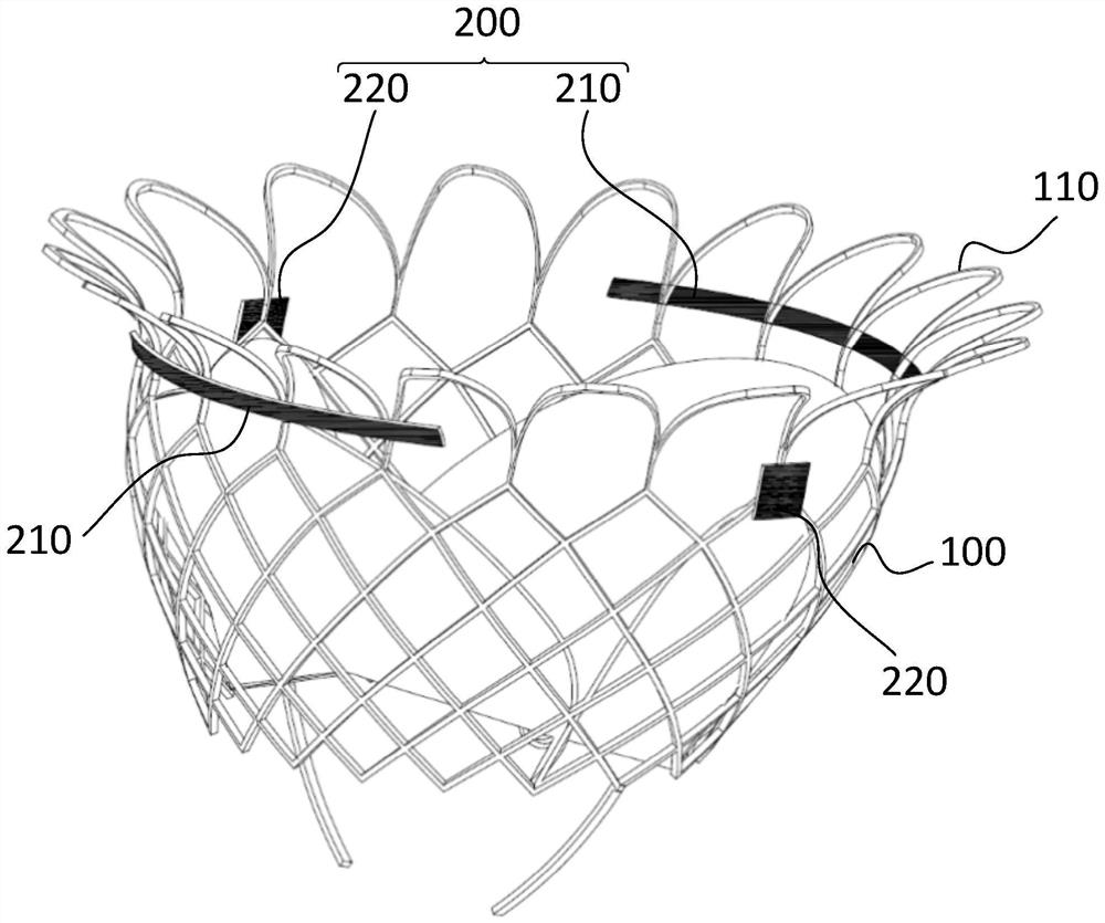 Interventional valve capable of being implanted under guidance of ultrasonic development