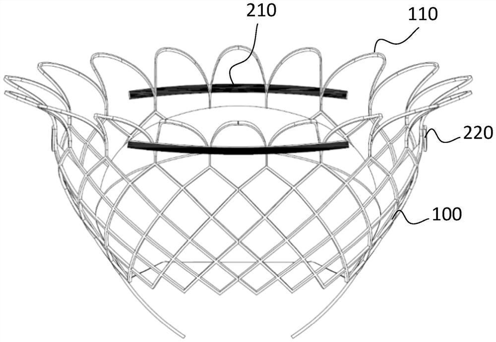 Interventional valve capable of being implanted under guidance of ultrasonic development