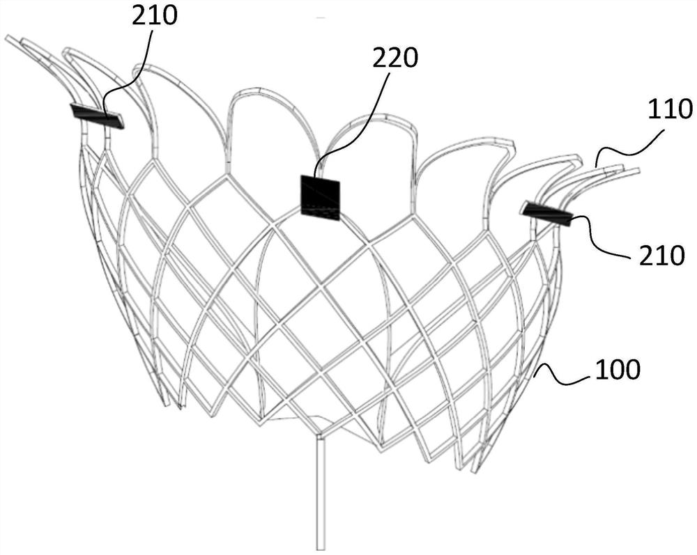 Interventional valve capable of being implanted under guidance of ultrasonic development