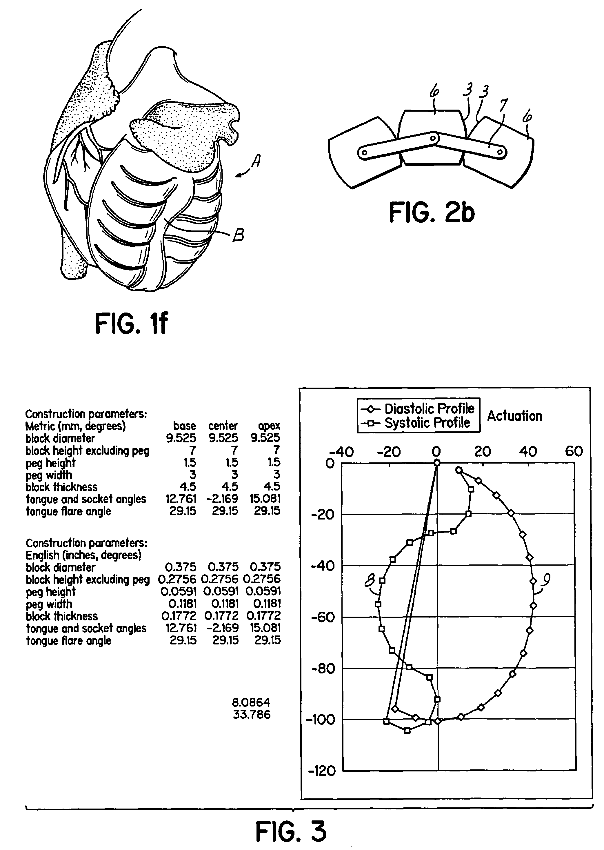 Actuation mechanisms for a heart actuation device