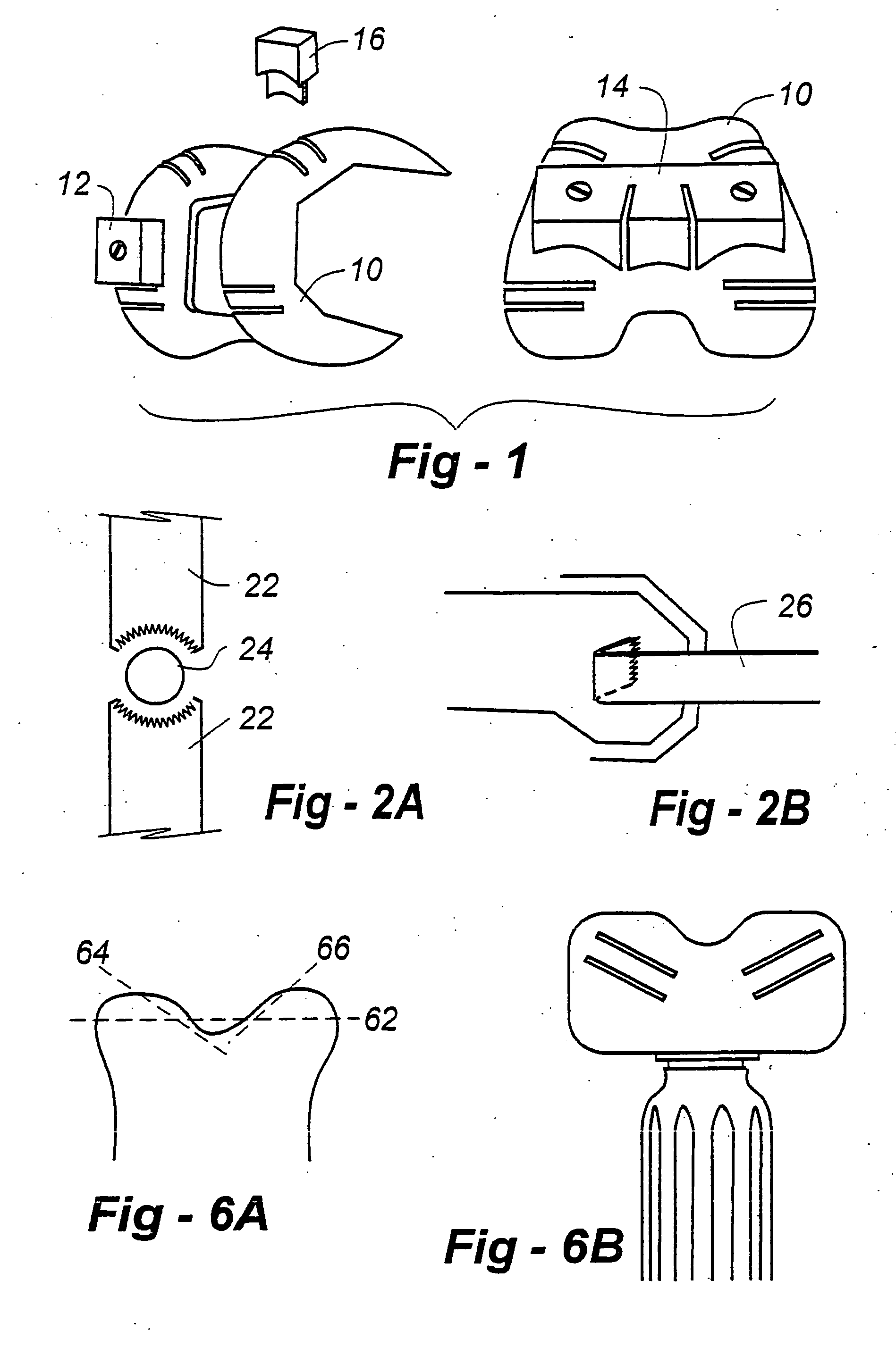 Joint replacement methods and apparatus