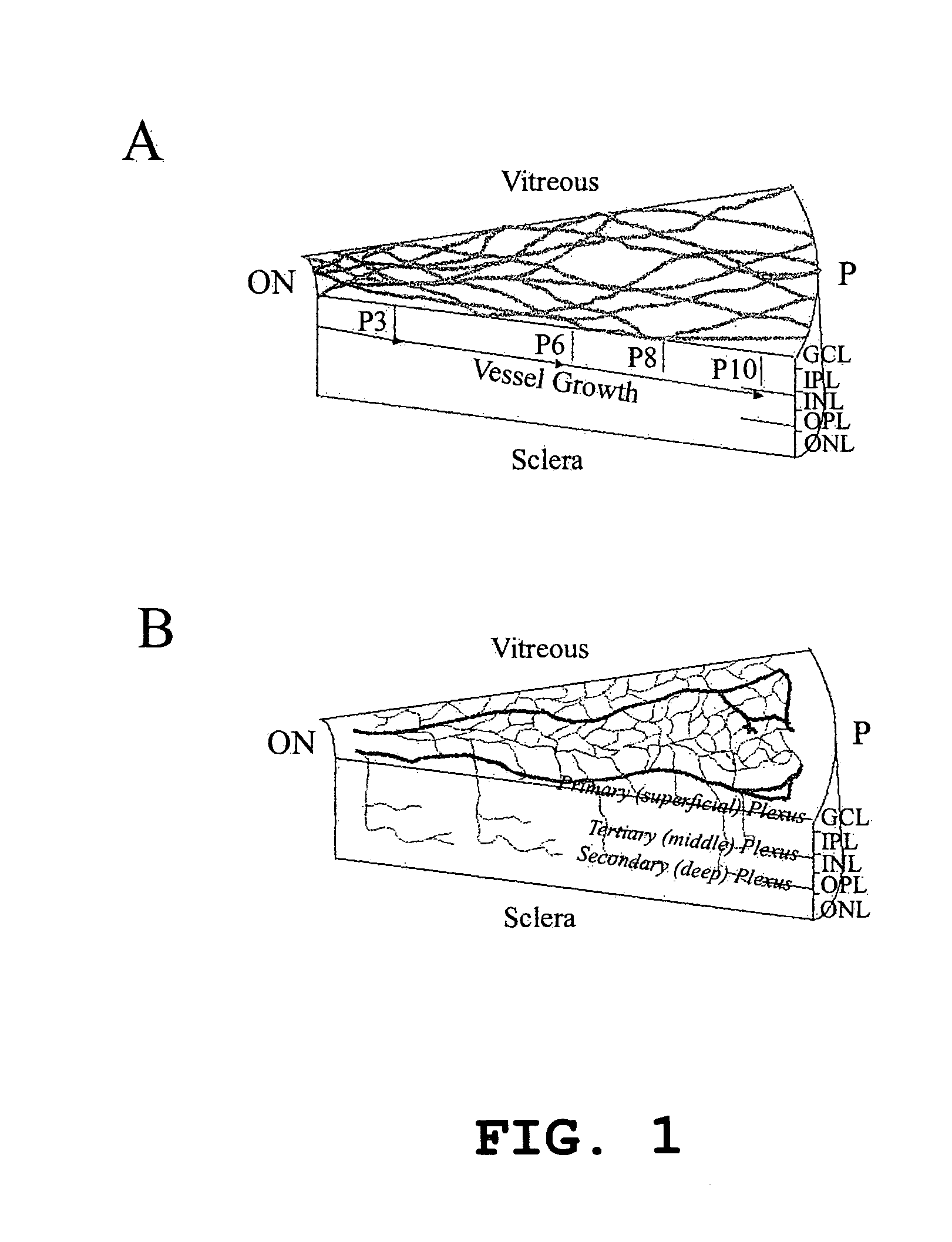 Hematopoietic stem cells and methods of treatment of neovascular eye diseases therewith