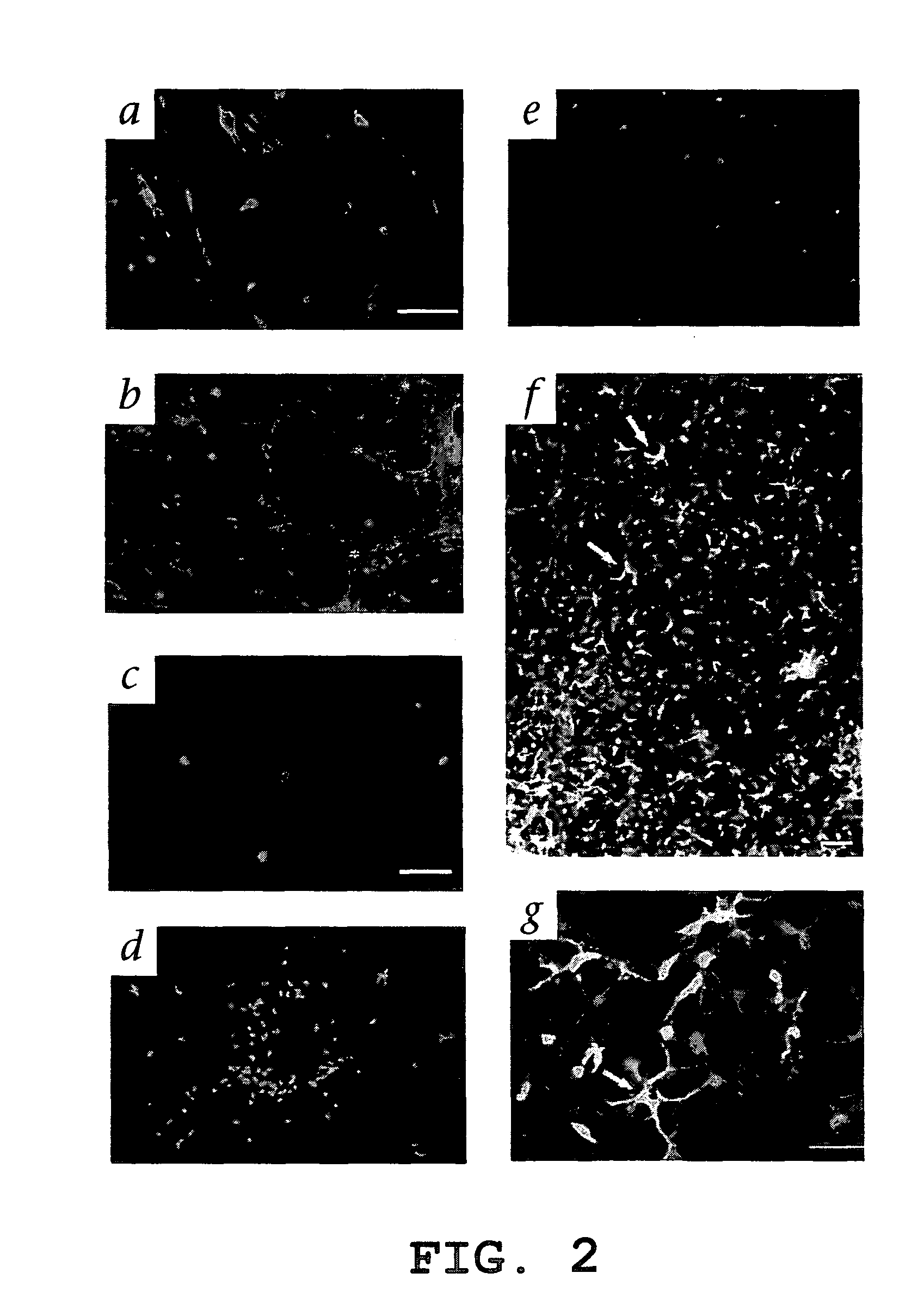 Hematopoietic stem cells and methods of treatment of neovascular eye diseases therewith