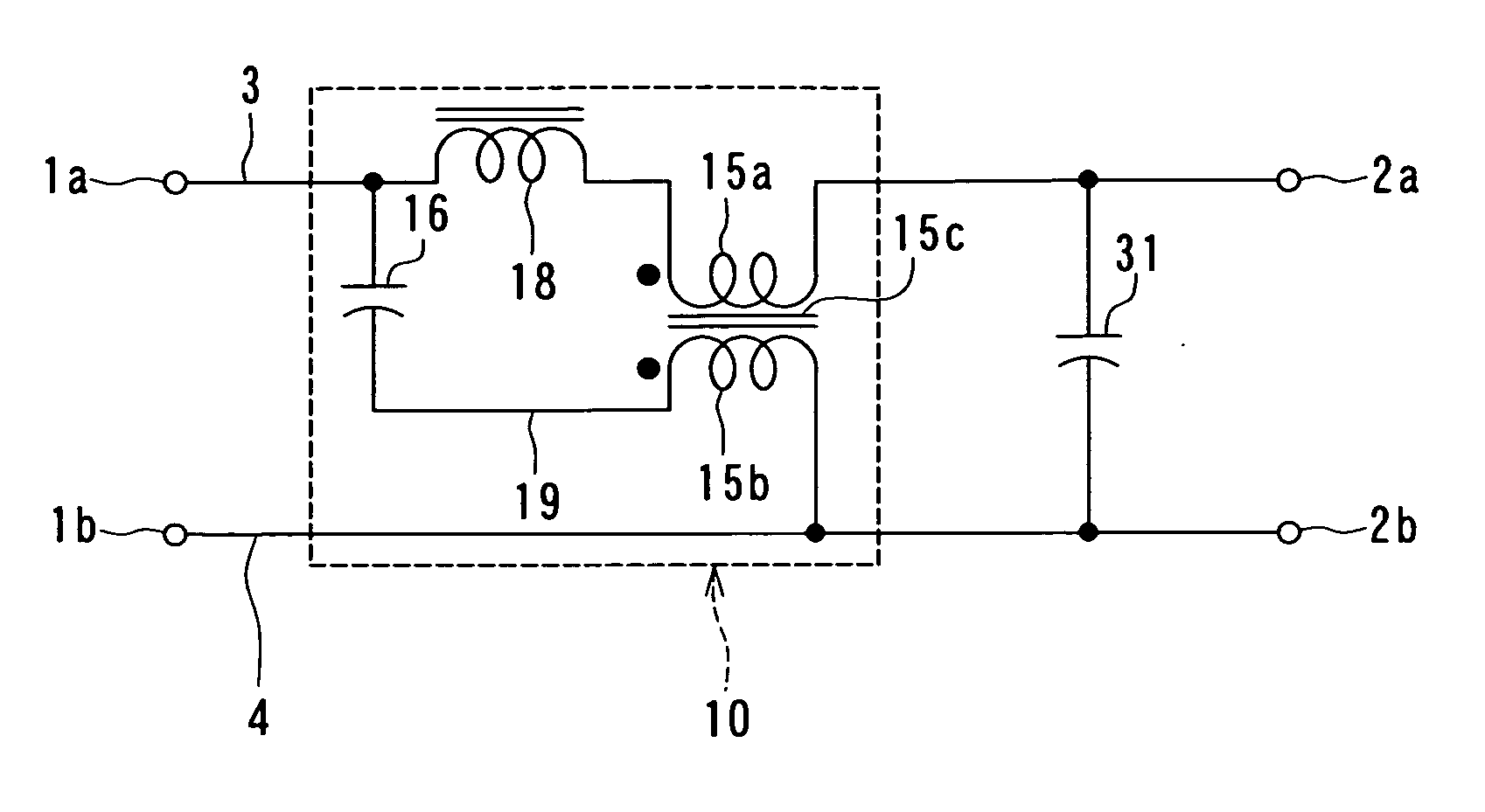 Normal mode noise suppressing circuit