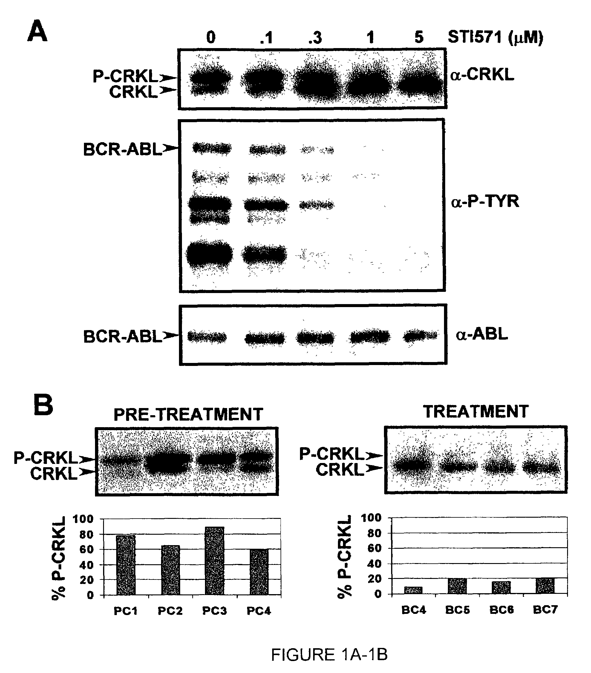 Mutations in the Bcr-Abl tyrosine kinase associated with resistance to STI-571