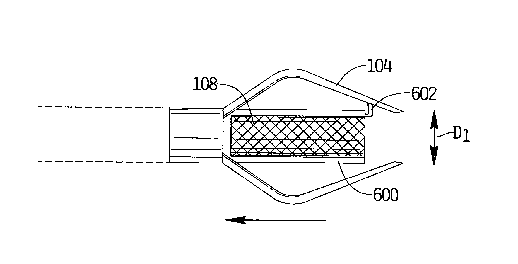 Method and apparatus for caged stent delivery