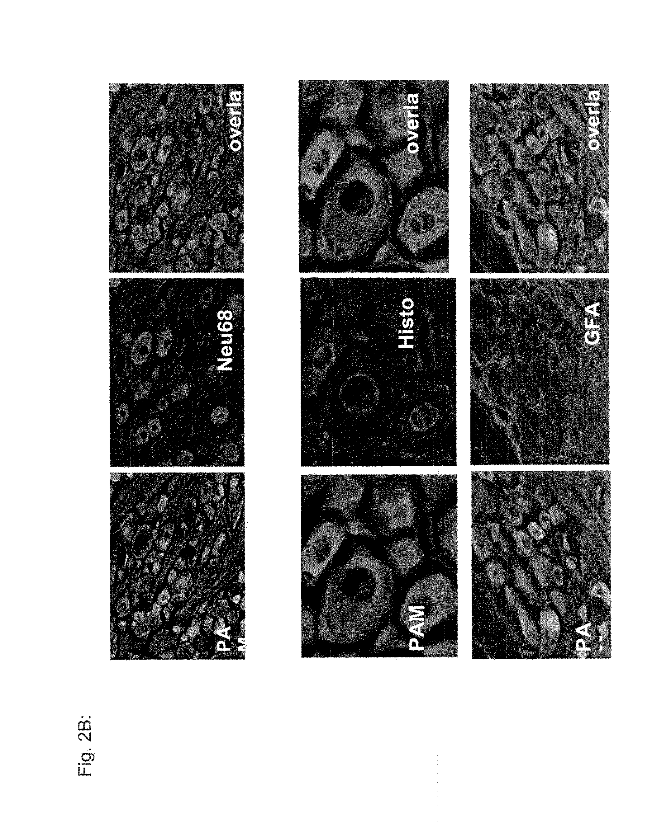 Method for alleviating pain using sphingosine-1-phosphate and related compounds, and assays for identifying such compounds