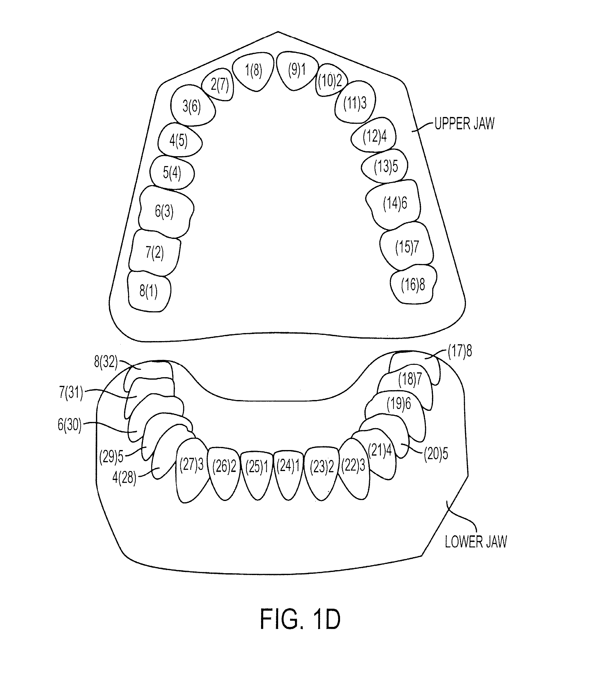 Automated treatment staging for teeth