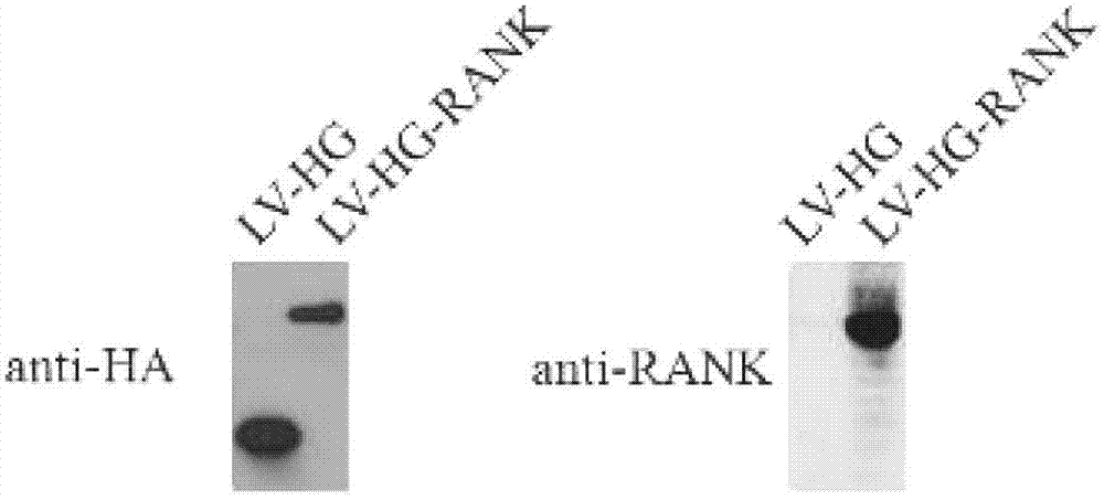 Fusion protein capable of targeting activation of RANK signal pathway and recombinant plasmid and application thereof