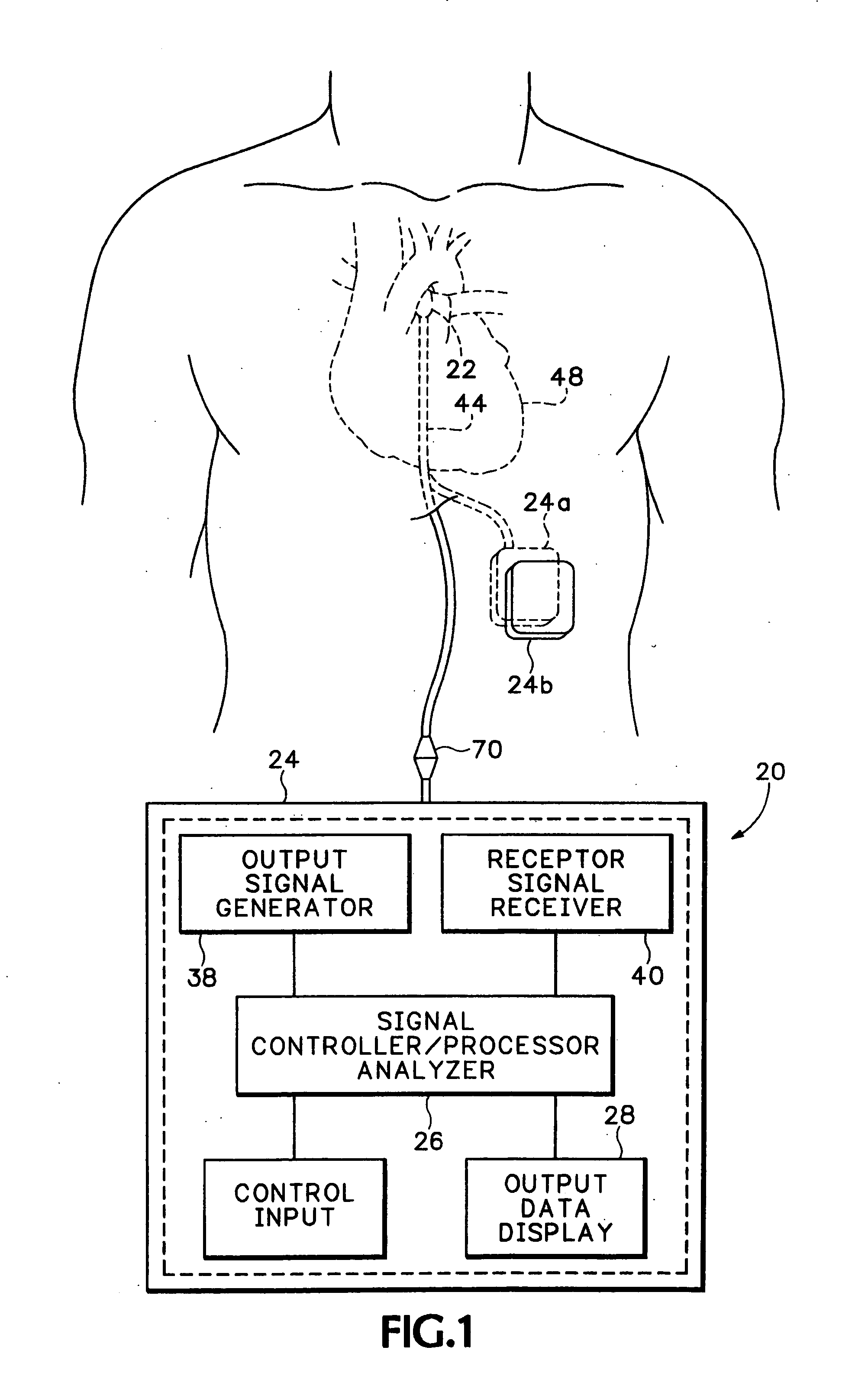 Method and apparatus for monitoring blood condition and cardiopulmonary function