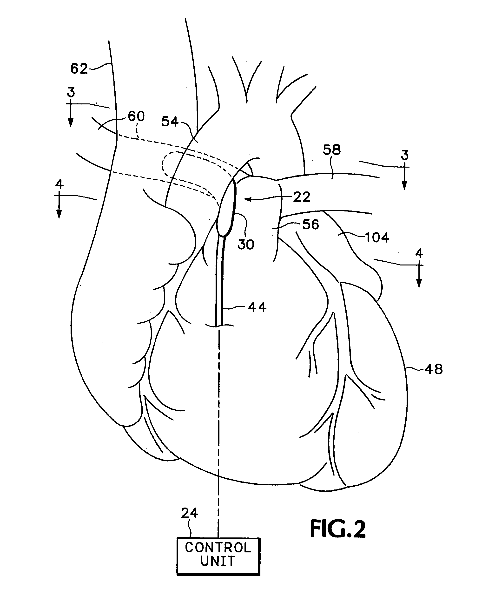 Method and apparatus for monitoring blood condition and cardiopulmonary function