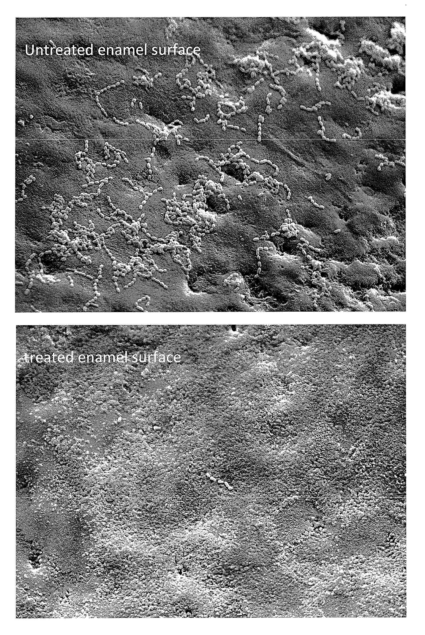 Anti-Bacterial and Mineralizing Calcium Phosphate Compositions