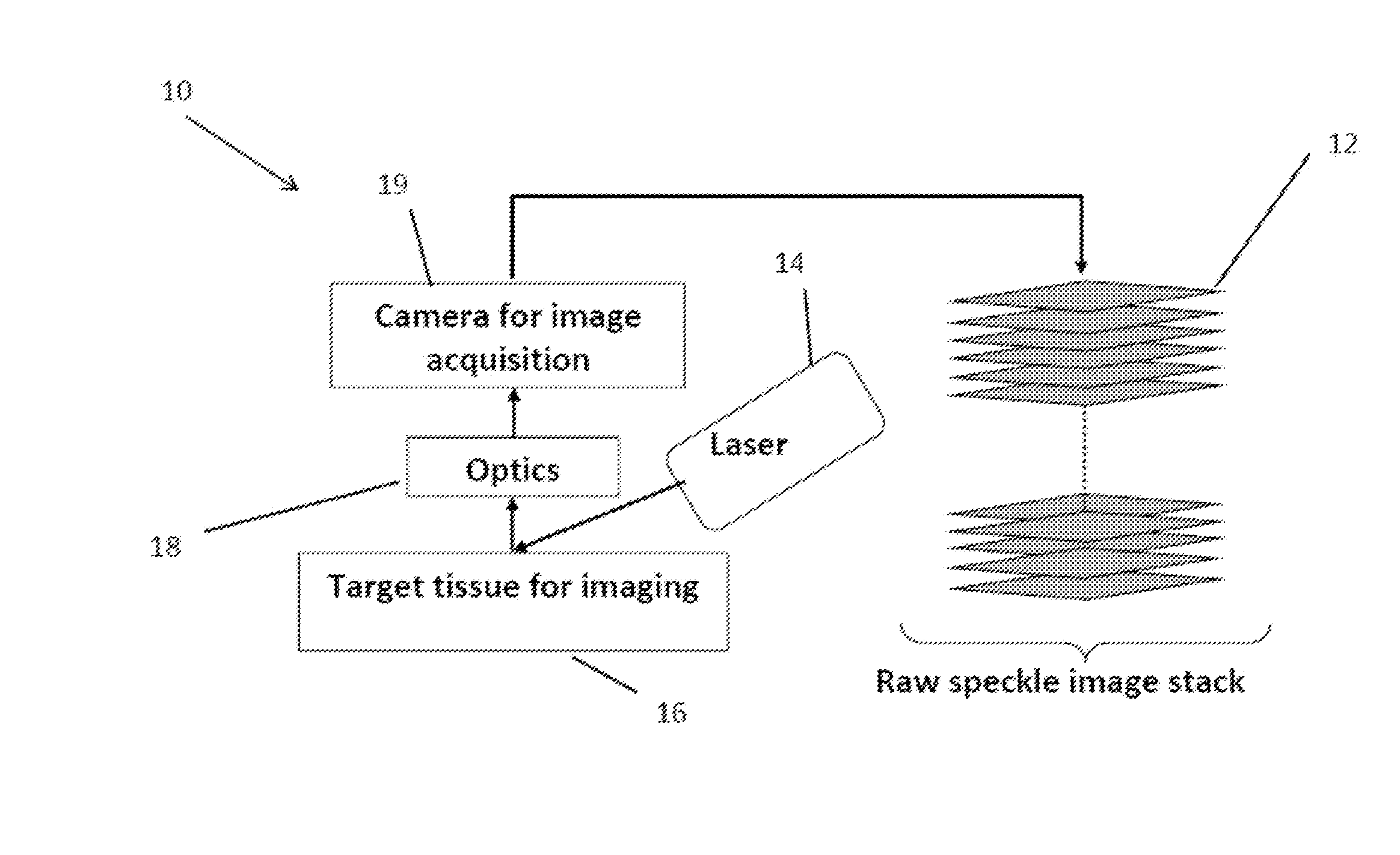 Anisotropic processing of laser speckle images