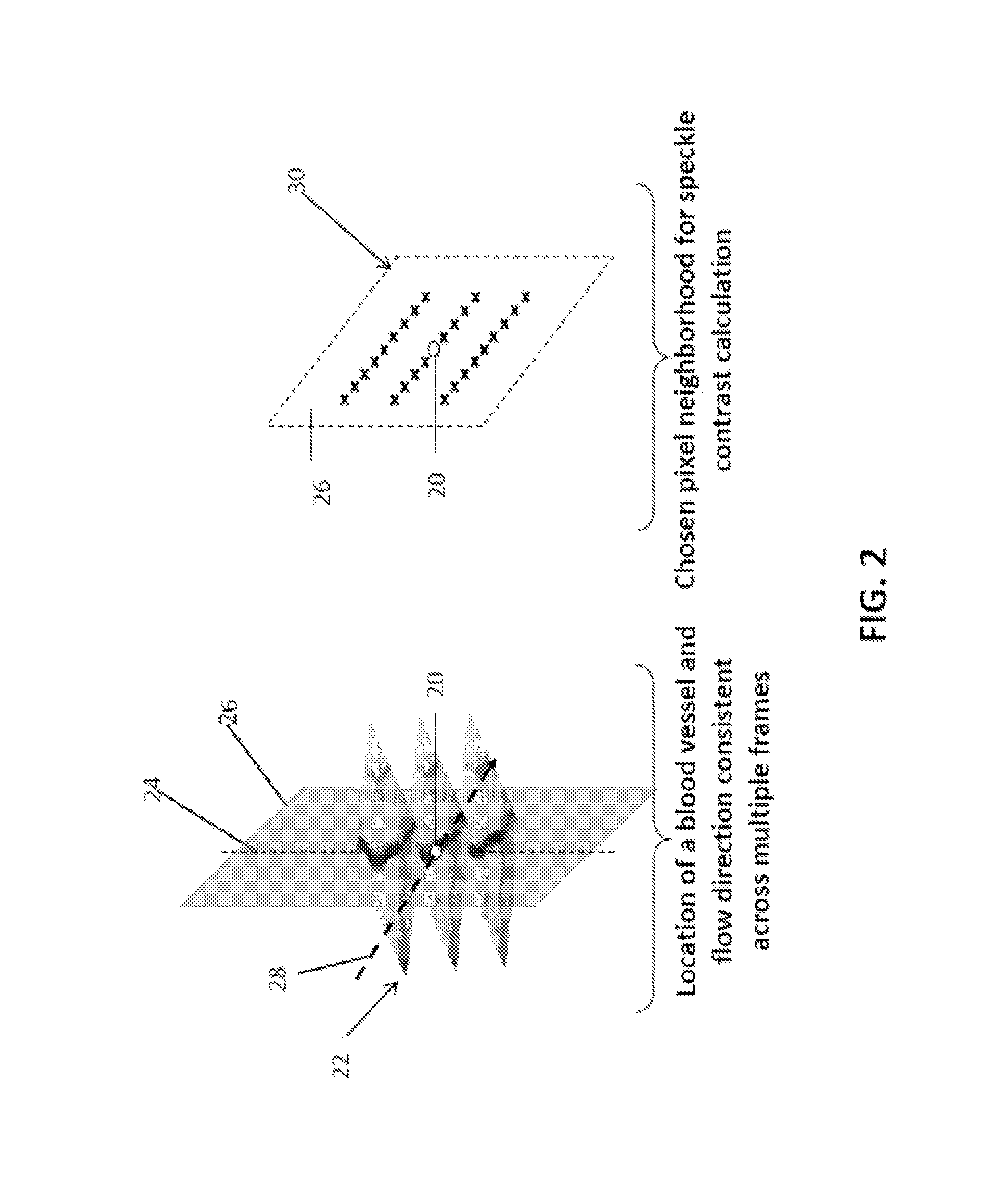 Anisotropic processing of laser speckle images