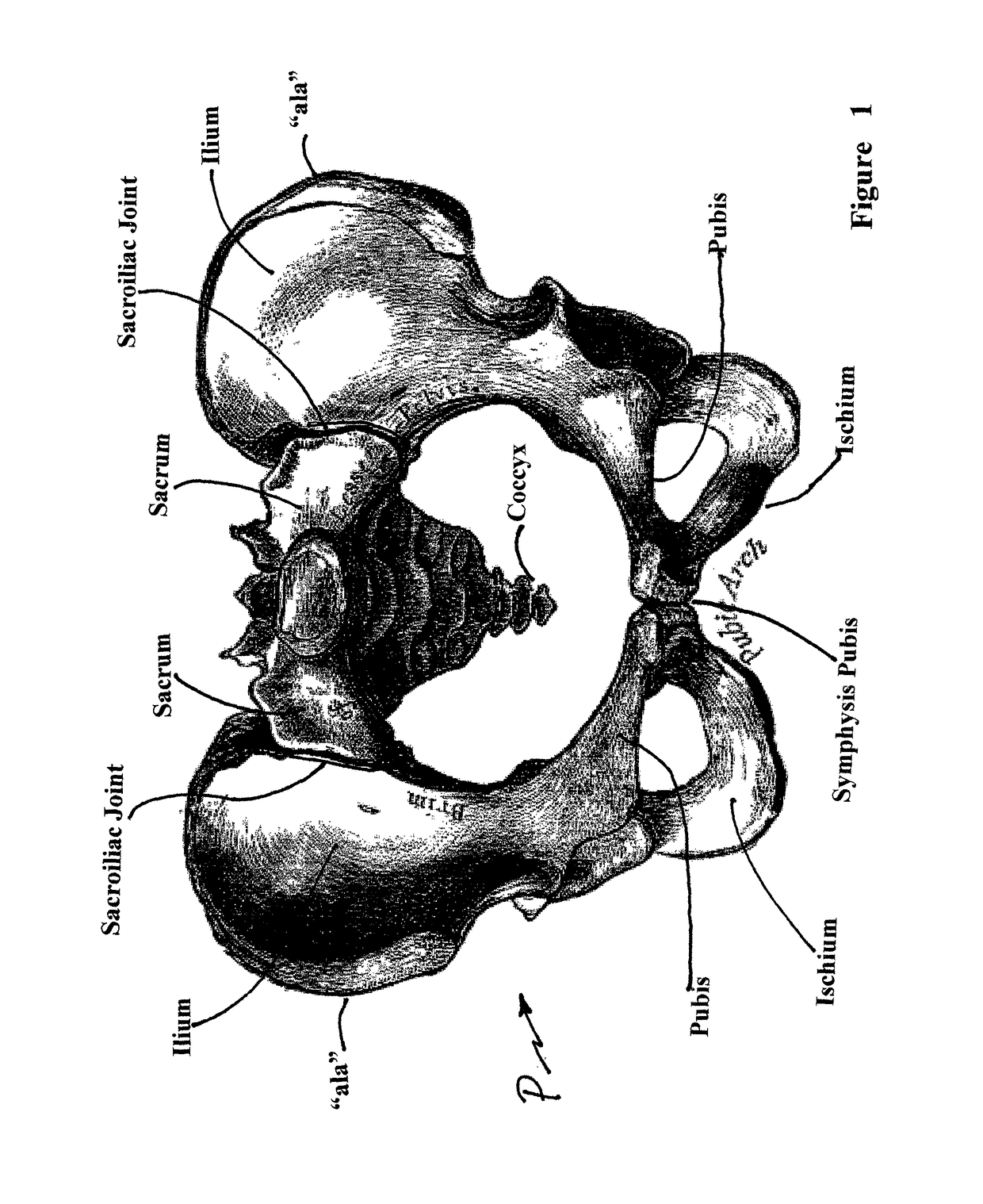 Birth ease method and device