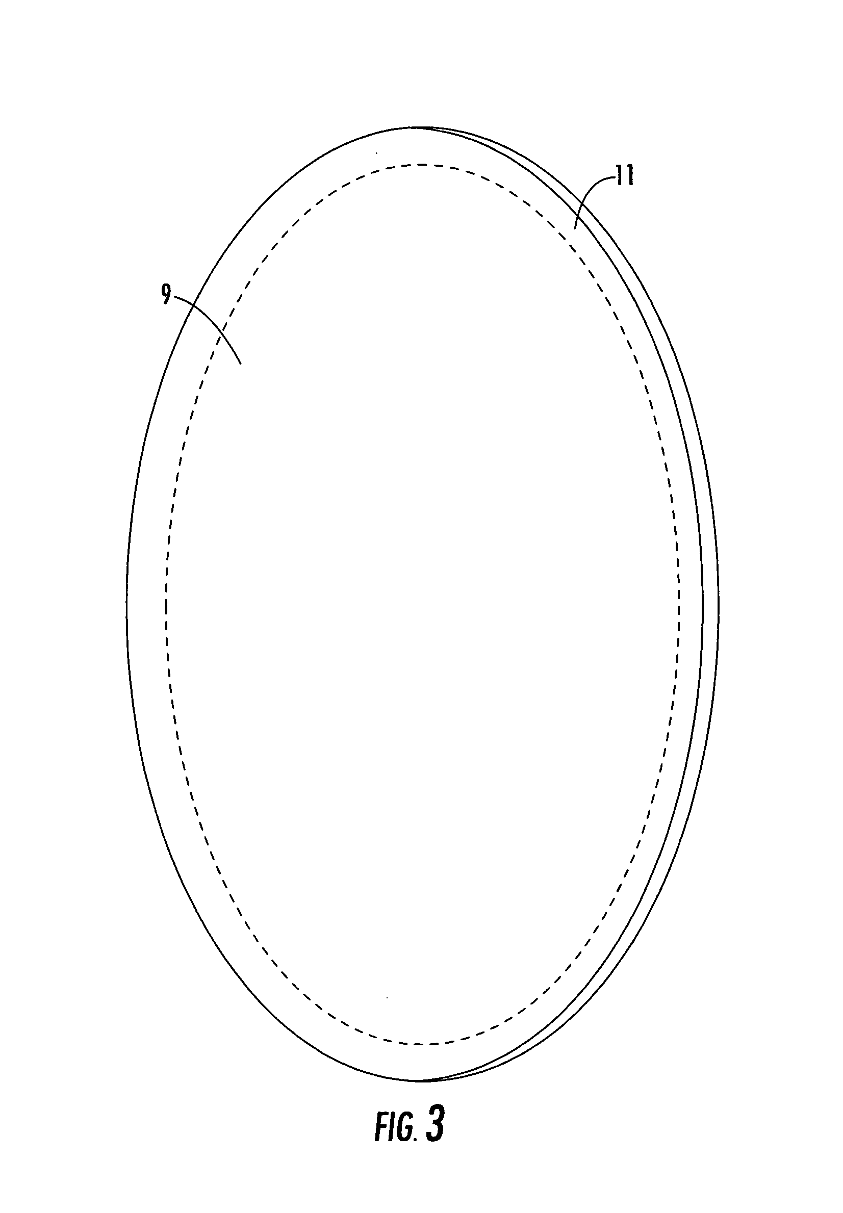 Reflector antenna radome with backlobe suppressor ring and method of manufacturing